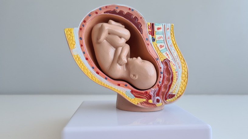 A detecção precoce de infecções fetais em exames de imagem é fundamental para garantir a saúde do bebê, com Dra. Thaline Neves.
