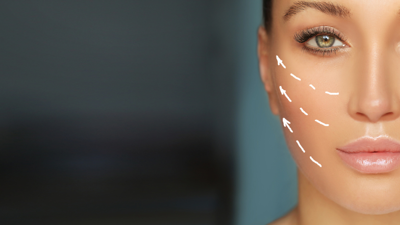 O minilifting é a escolha ideal para quem busca rejuvenescimento sem grandes intervenções, comenta Milton Seigi Hayashi.